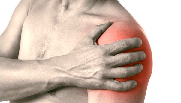 Pietūkums, apsārtums un palielināts plecs - pleca locītavas artrozes simptomi 2-3 pakāpe