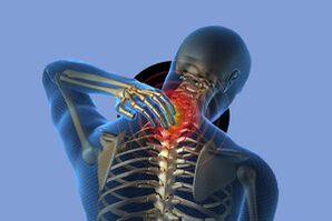 Dzemdes kakla osteohondrozes simptomi